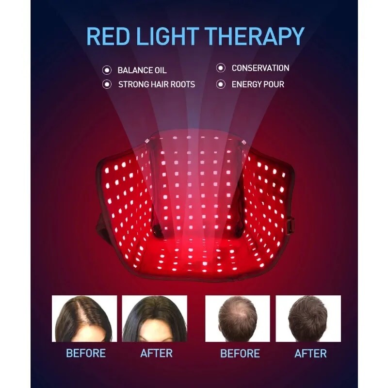 두피마사지기 전동 머리 관리기 탈모 적색광 테라피 라이트 근적외선 모발 성장 피마늘 유성 천연 장치