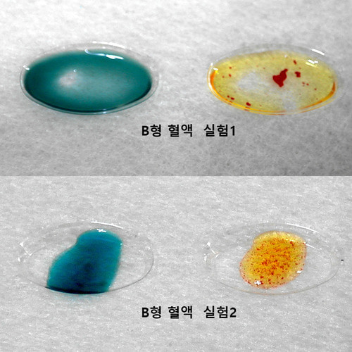[오늘출발] 혈액형 판별 실험 (5인세트)