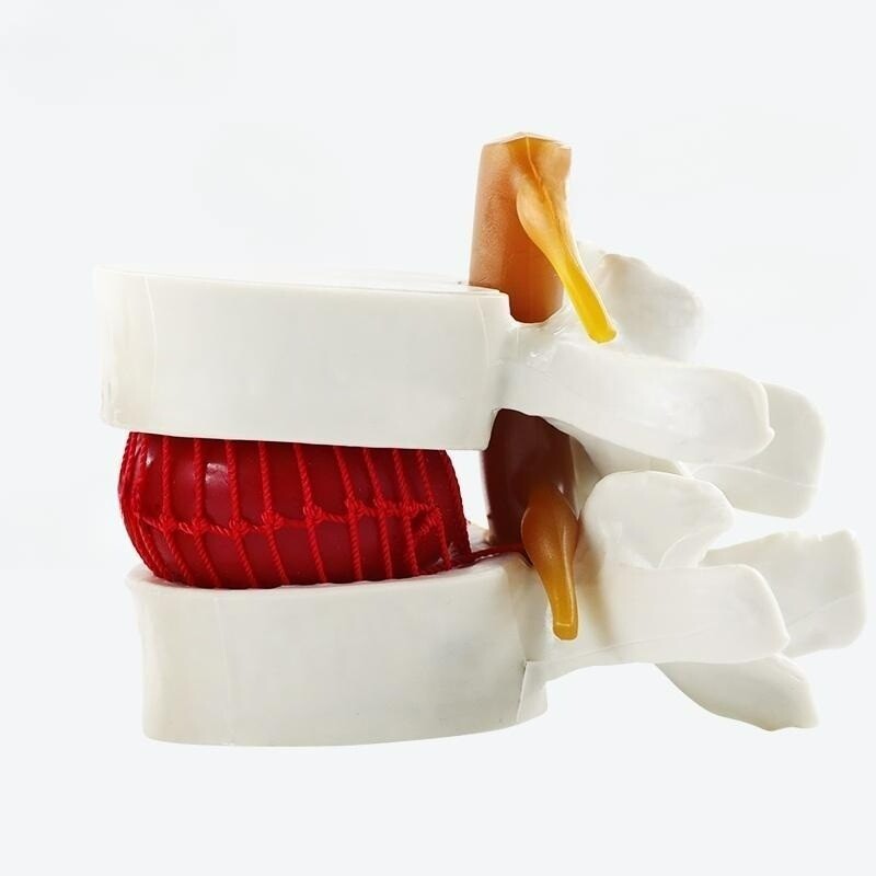 디스크 모형 해부학 인체 한의원 관절 뼈 병리학 모델