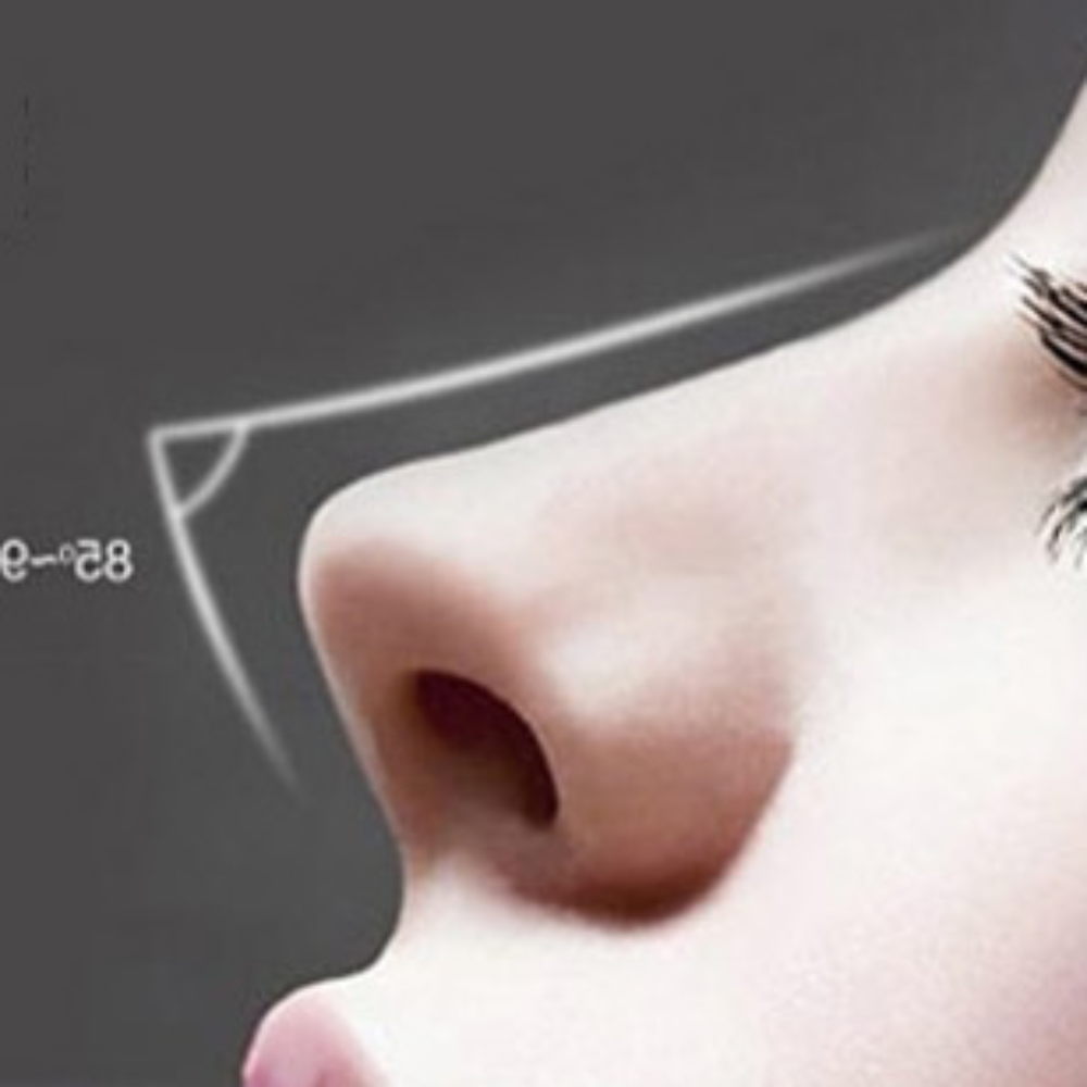 복코교정 코볼축소 오똑코교정기 매부리코교정 휜코교정기