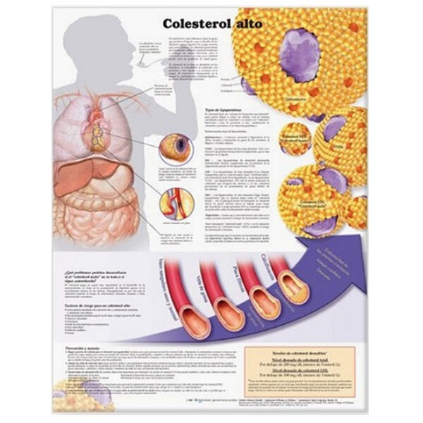 [오늘출발] 인체차트 3D해부도(벽걸이) 9103 콜레스테롤 차트 Size54cmx74cm 인체해부도