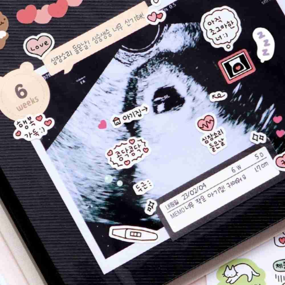 [오늘출발] 초음파앨범 임신 주수 스티커 꾸미기 세트 10종 임신초기선물 초음파스티커 초음파앨범꾸미기 초기임산부선