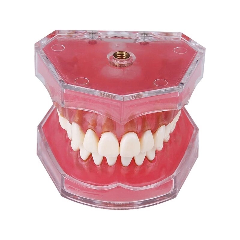 치과 치아틀 모형 구강 교육 병원 치과 교정 발치 상담 실습 모형 덴티폼 전체 구강 분리형 레진 치아 몰드