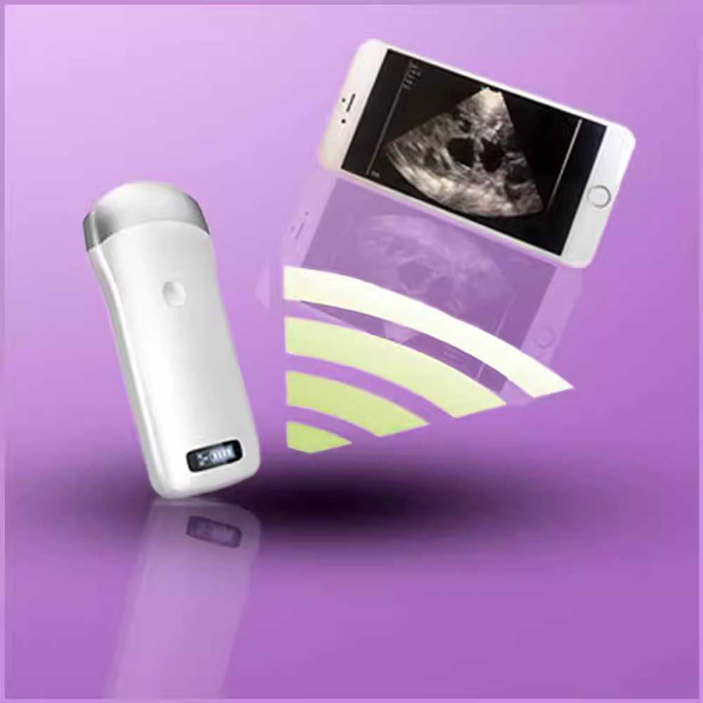 동물임신 배란 무선초음파 테스터기 축사 교배 테스터