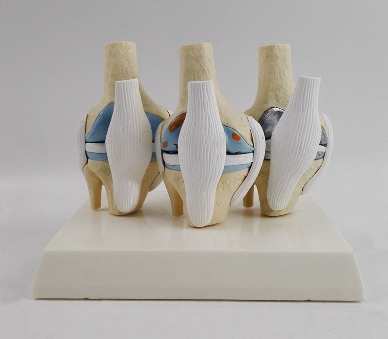 무릎관절 모형 부분치환술 인공 골격 훈련 인체 교육 인대 실습 교구 학교 기능 해부학