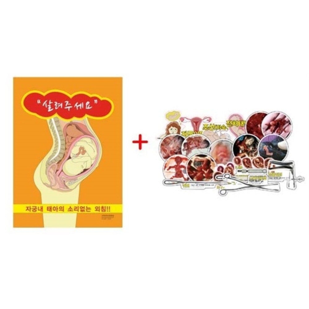 학교 보건소 청소년 성교육용 낙태 위험성 27종 자석형 보드판세트 학습용 병원
