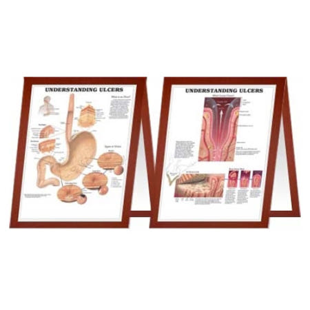 위궤양 차트(9731D,3D 입체) - 데스크탑 양면 인체해부도