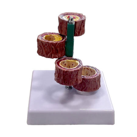 동맥 모형 심혈관계 구조 기관 관상동맥 지방단백질 혈전 혈정 대혈관 단면 차양혈관