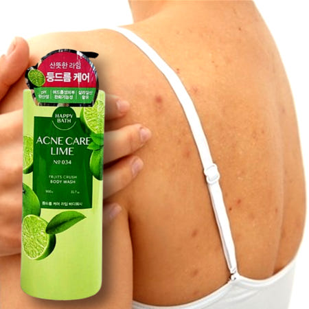 등드름 바디워시 남자 등에난 여드름 뽀드락지 뾰루지 관리 사춘기 냄새 없애는 원인제거